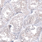 Anti-RRP1B Antibody
