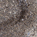 Immunohistochemical staining of human tonsil shows moderate to strong nuclear positivity in non-germinal center cells.