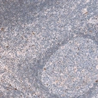 Immunohistochemical staining of human tonsil shows strong positivity in nucleoli in non-germinal center cells and germinal center cells.