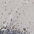 Immunohistochemical staining of human cerebellum shows moderate to strong nuclear positivity in cells in molecular layer.