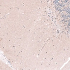 Immunohistochemical staining of human cerebellum shows strong positivity in nucleoli in Purkinje cells and cells in molecular layer.