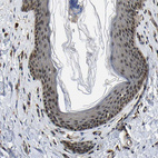 Immunohistochemical staining of human skin shows moderate to strong nuclear positivity in keratinocytes.