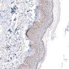 Immunohistochemical staining of human skin shows strong positivity in nucleoli in squamous epithelial cells.