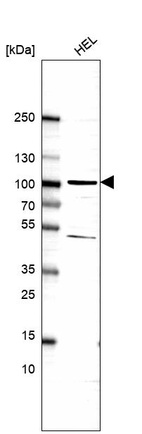 Western blot analysis in human cell line HEL.