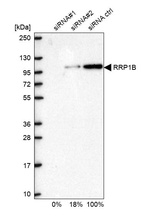 Anti-RRP1B Antibody