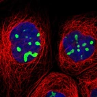 Immunofluorescent staining of human cell line A-431 shows localization to nucleoli.