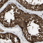 Immunohistochemical staining of human testis shows strong cytoplasmic positivity in cells in seminiferous ducts.