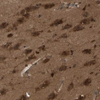 Immunohistochemical staining of human cerebral cortex shows moderate cytoplasmic positivity in neurons.
