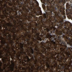 Immunohistochemical staining of human pancreas shows strong cytoplasmic positivity in exocrine glandular cells.
