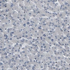 Immunohistochemical staining of human liver shows very weak cytoplasmic positivity in hepatocytes.