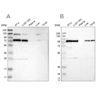 Western blot analysis using Anti-GARS antibody HPA017896 (A) shows similar pattern to independent antibody HPA019097 (B).