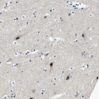 Immunohistochemical staining of human cerebral cortex shows strong nuclear positivity in neuronal cells.