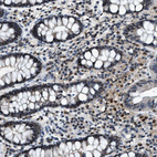 Immunohistochemical staining of human gastrointestinal shows strong nuclear positivity in glandular cells.