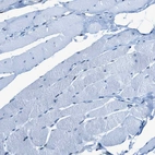 Immunohistochemical staining of human skeletal muscle shows no positivity in myocytes as aspected.