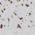 Anti-CSRNP3 Antibody
