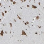 Anti-CSRNP3 Antibody