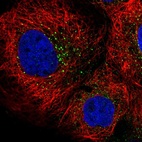Immunofluorescent staining of human cell line A-431 shows localization to vesicles.