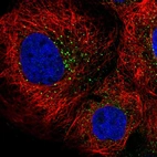 Immunofluorescent staining of human cell line A-431 shows localization to vesicles.