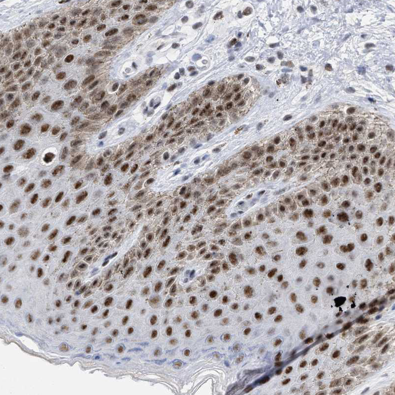 Anti-DDX41 Antibody