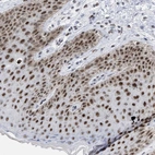 Anti-DDX41 Antibody