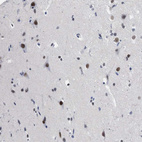 Immunohistochemical staining of human cerebral cortex shows strong nuclear positivity in neurons.