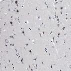 Immunohistochemical staining of human cerebral cortex shows strong nuclear positivity in neurons.
