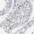 Immunohistochemical staining of human testis shows moderate nuclear positivity in subset of cells in seminiferous ducts.