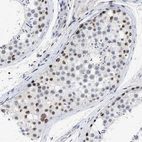 Immunohistochemical staining of human testis shows moderate nuclear positivity in subset of cells in seminiferous ducts.