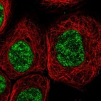 Immunofluorescent staining of human cell line A-431 shows localization to nucleoplasm.