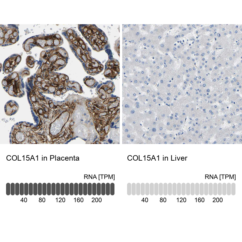 Anti-COL15A1 Antibody