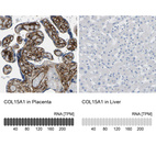 Anti-COL15A1 Antibody