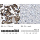 Anti-COL15A1 Antibody