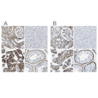 Immunohistochemical staining of human kidney, liver, placenta and testis using Anti-COL15A1 antibody HPA017913 (A) shows similar protein distribution across tissues to independent antibody HPA017915 (B).