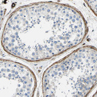 Immunohistochemical staining of human testis shows strong positivity in peritubular myoid cells.