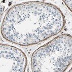 Immunohistochemical staining of human testis shows strong positivity in peritubular myoid cells.