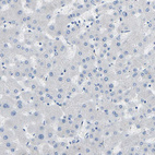 Anti-COL15A1 Antibody