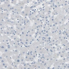 Immunohistochemical staining of human liver shows no positivity in hepatocytes as expected.