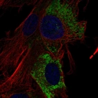 Immunofluorescent staining of human cell line BJ shows localization to endoplasmic reticulum.