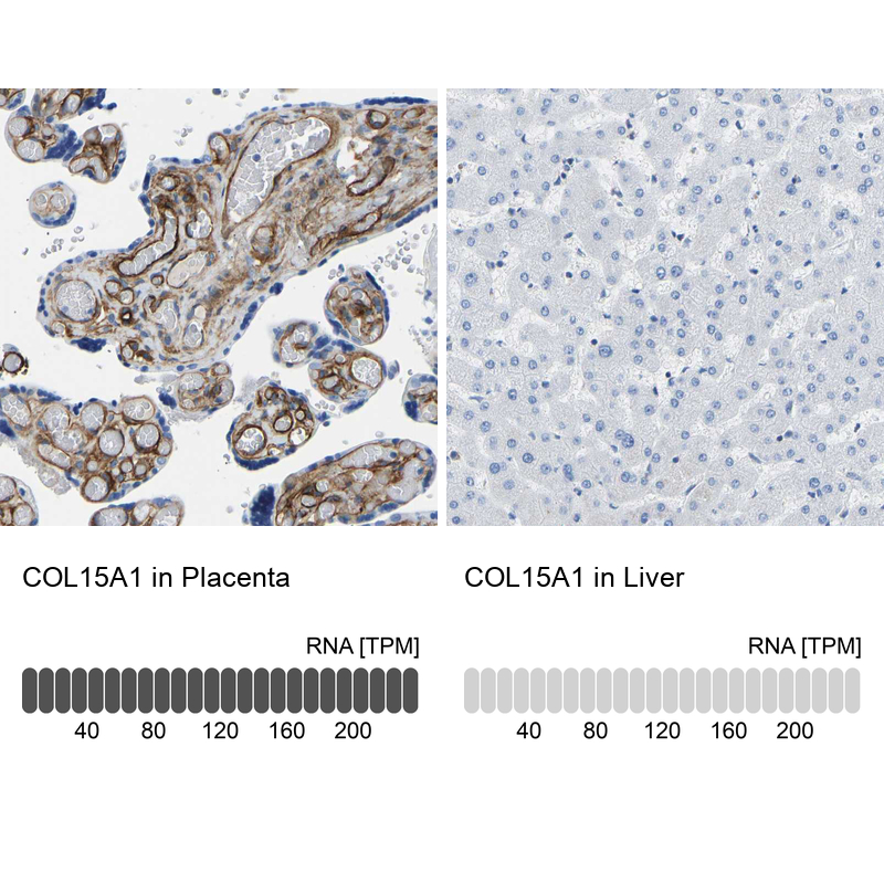 Anti-COL15A1 Antibody