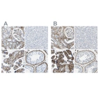 Immunohistochemical staining of human kidney, liver, placenta and testis using Anti-COL15A1 antibody HPA017915 (A) shows similar protein distribution across tissues to independent antibody HPA017913 (B).