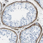 Immunohistochemical staining of human testis shows strong positivity in peritubular myoid cells.