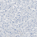 Anti-COL15A1 Antibody