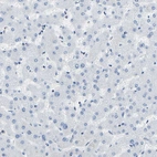 Immunohistochemical staining of human liver shows no positivity in hepatocytes as expected.