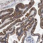 Anti-NDEL1 Antibody