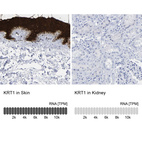 Anti-KRT1 Antibody