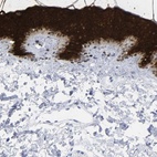 Immunohistochemical staining of human skin shows high expression.