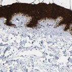 Immunohistochemical staining of human skin shows high expression.