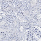 Immunohistochemical staining of human kidney shows low expression as expected.