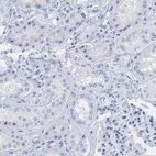 Anti-KRT1 Antibody