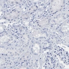 Immunohistochemical staining of human kidney shows low expression as expected.